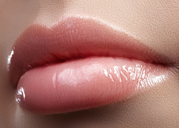 Can Lip Augmentation be Reversed