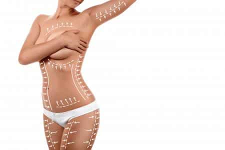 Body Contouring 0