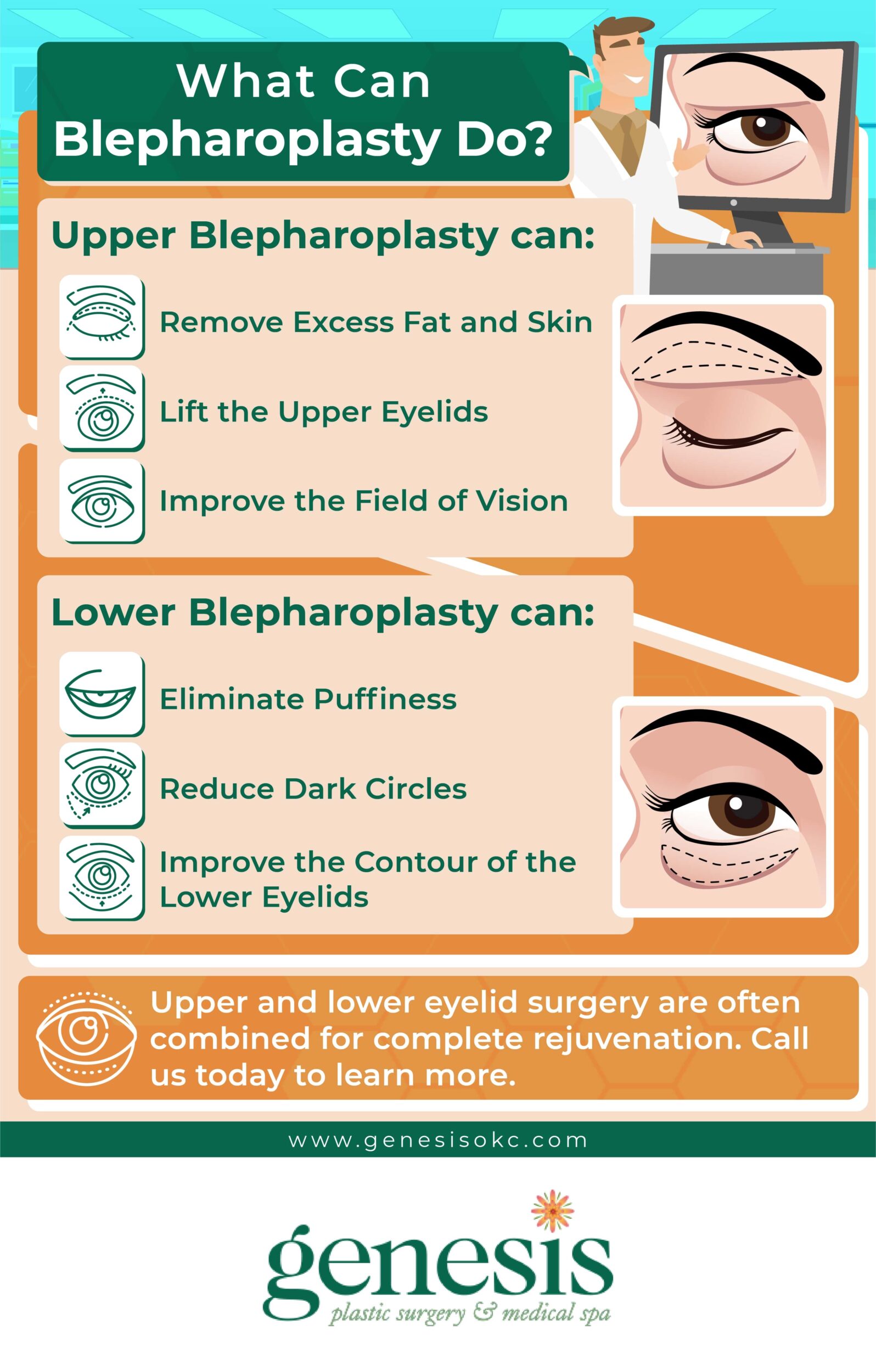 What Can Eyelid Surgery Do