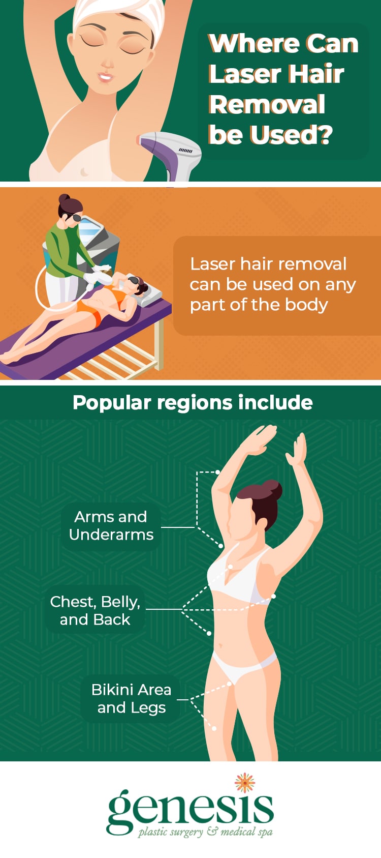 Where can laser hair removal be used