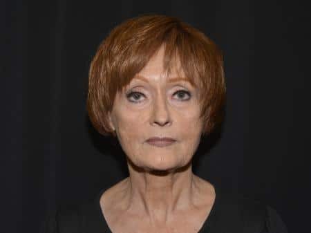 Before Image: Naturale Facelift - front