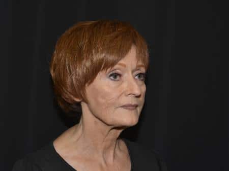 Before Image: Naturale Facelift - right-front-oblique