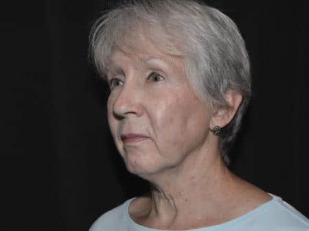 Before Image: Naturale Facelift - left-front-oblique