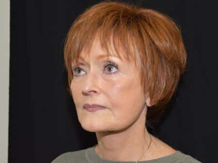 After Image: Naturale Facelift - left-front-oblique