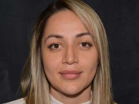 After Image: Nose Reshaping - front