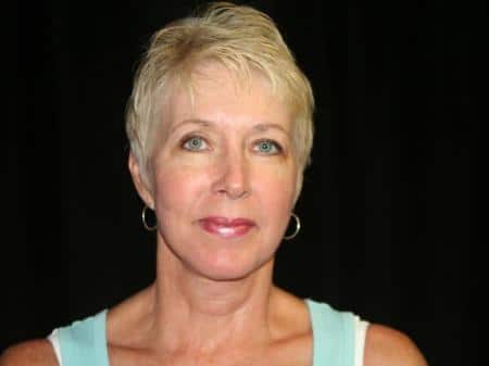 After Image: Naturale Facelift - front