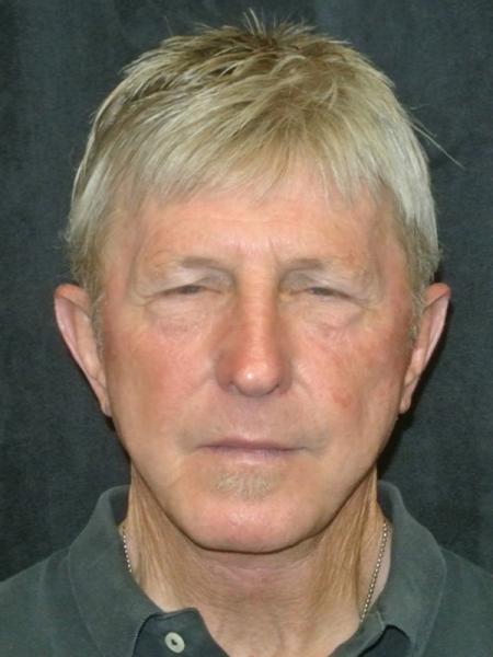 After Image
