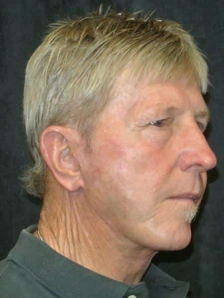 After Image