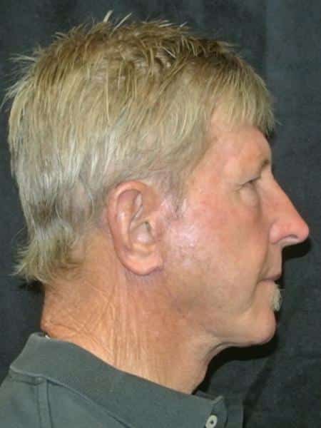 After Image