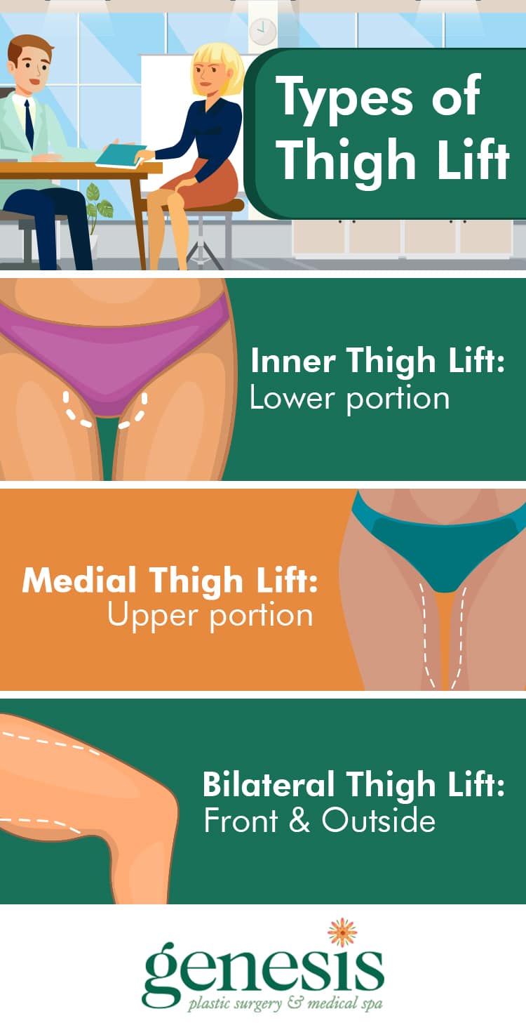 Types of thigh lift