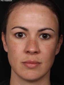 Before Image: Clear and Brilliant