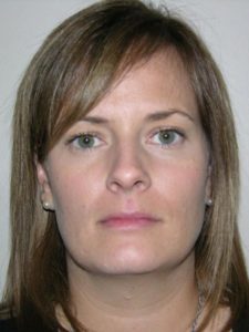 Before Image: Smartlipo