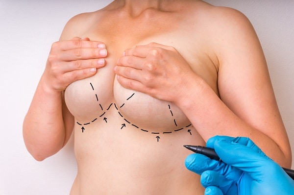 When is the Best Time for Breast Lift Surgery? - Genesis Plastic Surgery &  Medical Spa