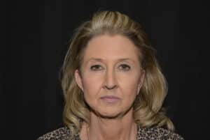 Naturale Facelift