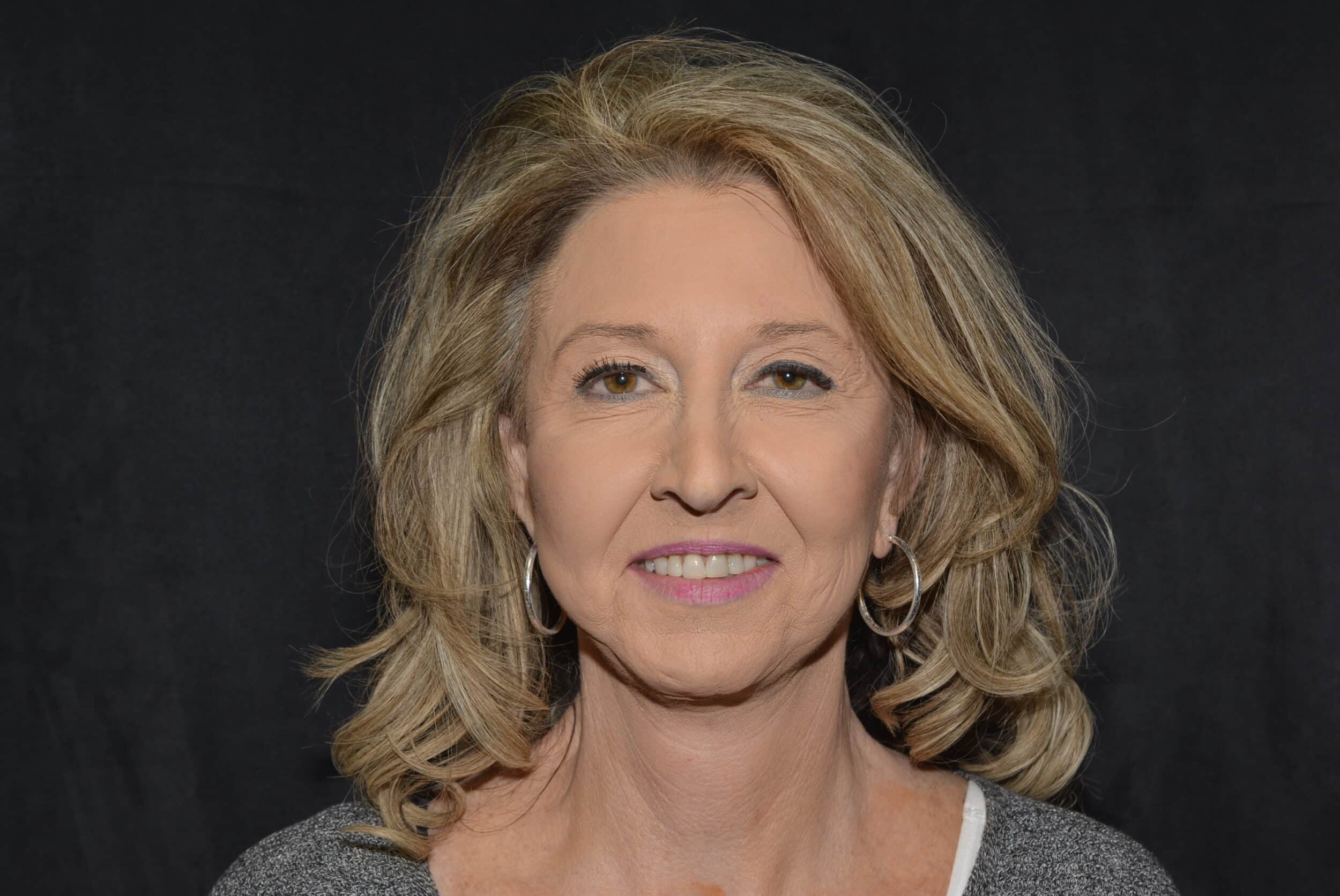 Naturale Facelift
