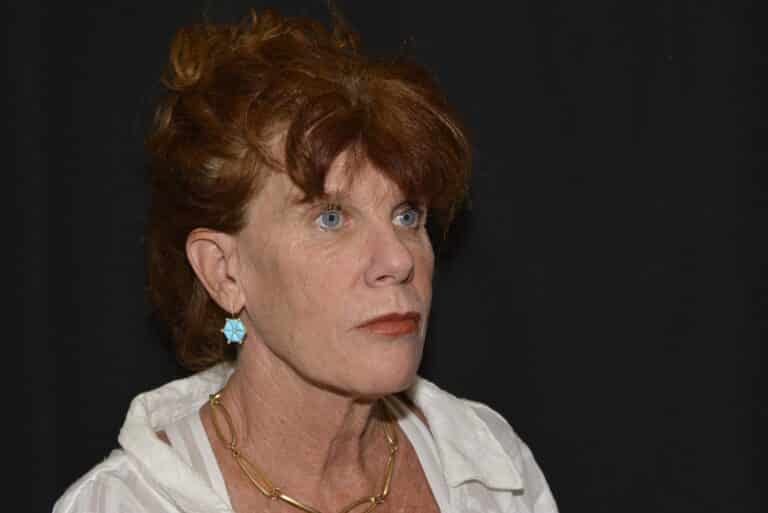 Before Image: Naturale Face Neck lift - front