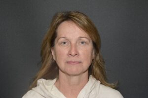 Before Image: Naturale face neck lift under Local Anesthesia and Oral Sedation