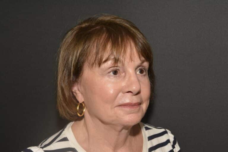 After Image: Lower eyelid surgery - 