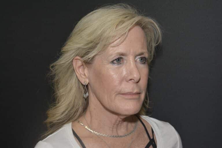 Before Image: Neck lift tonly - 
