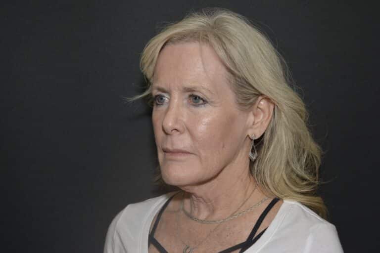 Before Image: Neck lift tonly - 