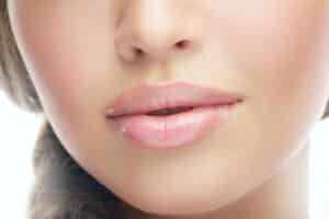 A close-up shot of a woman's lips after Restylane® Kysse in Norman, OK