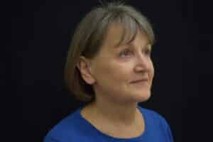 After Image: Naturale in office deep plane face-neck lift. In office under local anesthesia and oral sedation