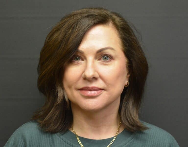 After Image: Naturale face-neck lift - front