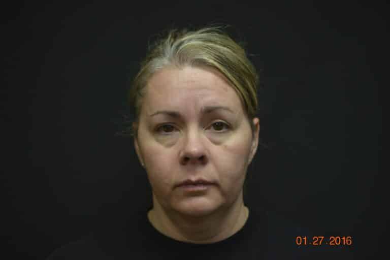 Before Image: Naturale face neck lift - 