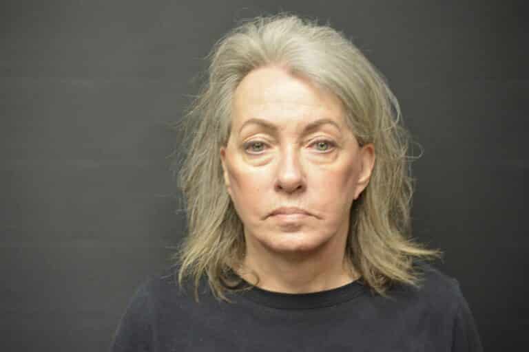 After Image: Naturale face-neck lift - 