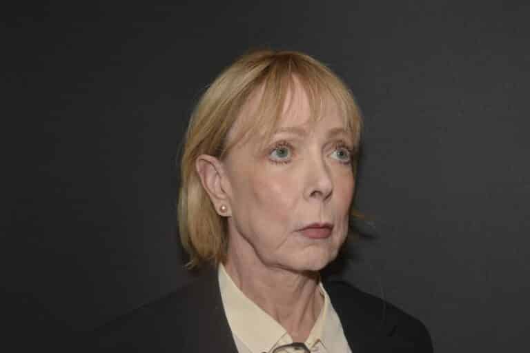 Before Image: Naturale face-neck lift with lip lift - 
