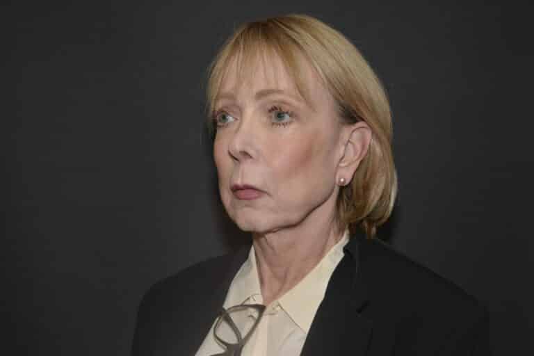 Before Image: Naturale face-neck lift with lip lift - front