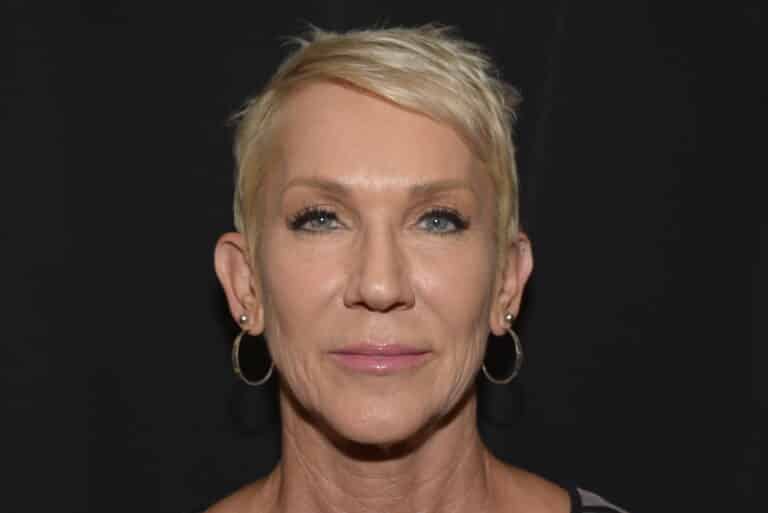 Before Image: Lip Lift - front