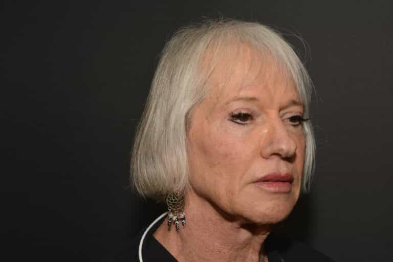 Before Image: Naturale Face neck lift - 