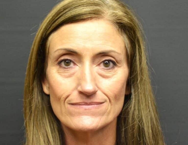 Before Image: Lower blepharoplasty - front
